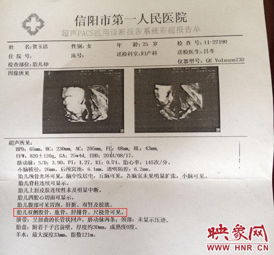 胎兒醫院四維彩超顯示一切正常 出生后肢體殘缺