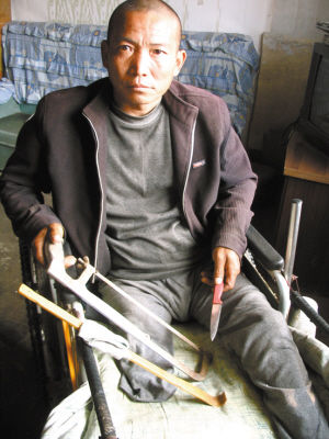 鄭艷良就是用這幾樣簡(jiǎn)陋工具，給自己做了右腿截肢手術(shù)。