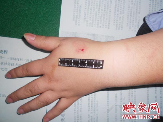 為幫助無證駕駛的朋友逃避處罰，新鄉的王某竟對執勤民警大打出手，還將一名民警的手臂咬傷