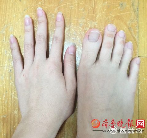 女大學生腳趾修長如手指