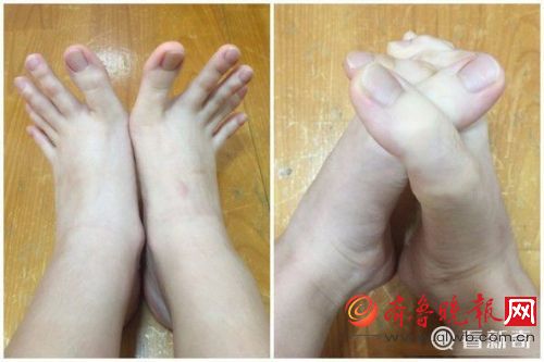 女大學生腳趾修長如手指
