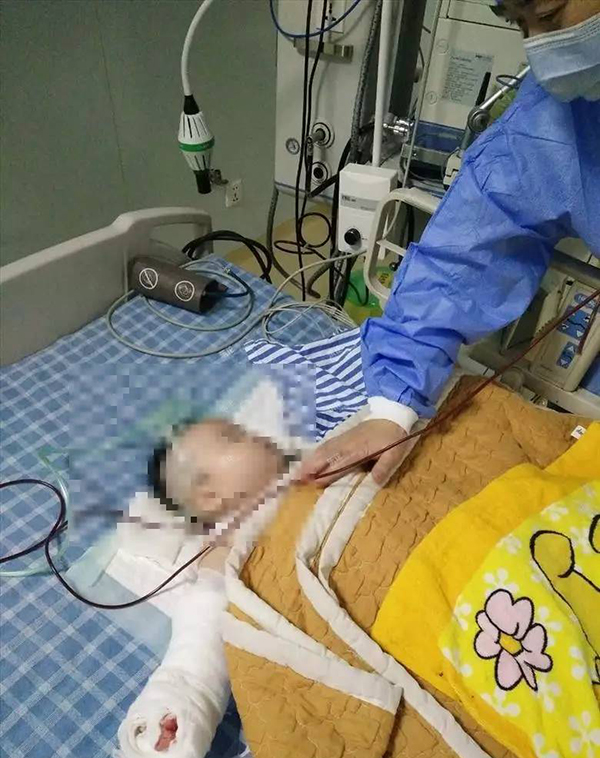 “嬰兒不小心被熱水燙傷，到寧波婦女兒童醫院住院，醫生換紗布時竟然剪下嬰兒小拇指！”近日，網友“menglei1988”以當事嬰兒家長口吻在寧波當地論壇發帖。