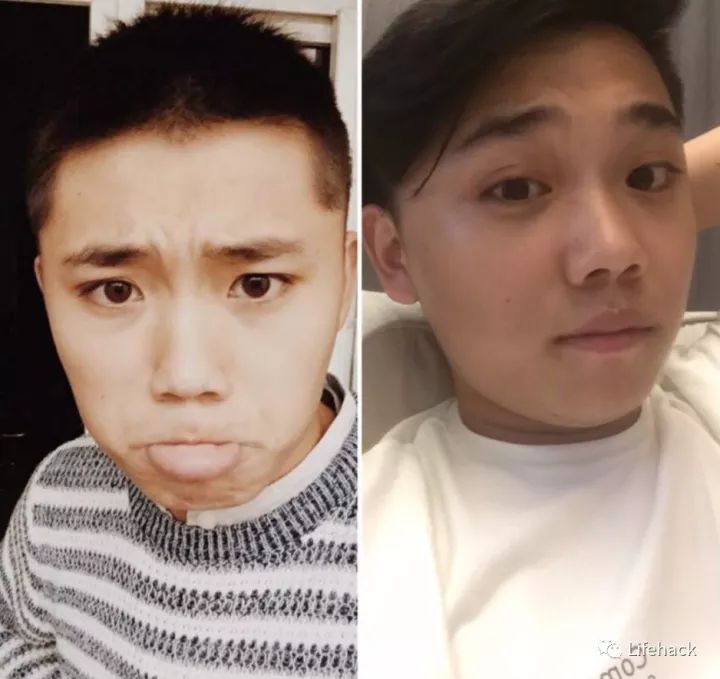 長胖20斤，臉型怎么變？這些例子看完扎心了！