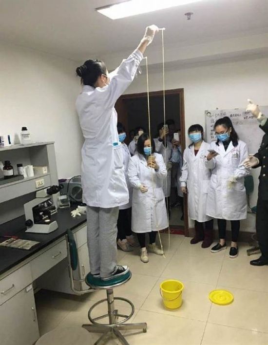 愛吃生肉惹的禍！男子體內(nèi)取出5米長寄生蟲(圖)